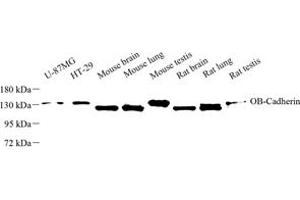 Western blot analysis of OB-Cadherin (ABIN7073255) at dilution of 1: 500 (OB Cadherin 抗体)