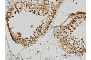 Immunoperoxidase of monoclonal antibody to IRAK1 on formalin-fixed paraffin-embedded human testis. (IRAK1 抗体  (AA 530-693))