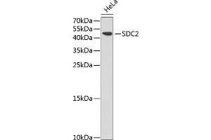 Western blot analysis of extracts of HeLa cells, using SDC2 antibody (ABIN3022587, ABIN3022588, ABIN3022589 and ABIN6218928) at 1:1000 dilution. (Syndecan 2 抗体  (AA 19-144))