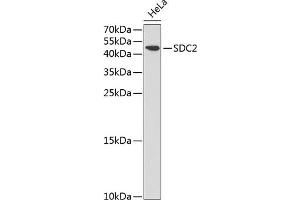 Western blot analysis of extracts of HeLa cells, using SDC2 antibody (ABIN3022587, ABIN3022588, ABIN3022589 and ABIN6218928) at 1:1000 dilution. (Syndecan 2 抗体  (AA 19-144))
