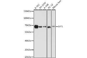 Western Blotting (WB) image for anti-Synaptotagmin I (SYT1) (AA 1-422) antibody (ABIN3021250)