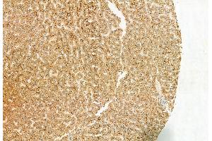 ABIN6262995 and ABIN6272963 at 1/100 staining Human normal tissues adjacent to liver cancer by IHC-P.