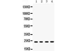 Western blot analysis of Rab9 expression in rat brain extract (lane 1), mouse brain extract (lane 2), HELA whole cell lysates (lane 3) and MCF-7 whole cell lysates (lane 4). (RAB9A 抗体  (C-Term))