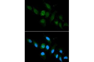 Immunofluorescence (IF) image for anti-Major Histocompatibility Complex, Class I, A (HLA-A) (AA 35-285) antibody (ABIN3023100)