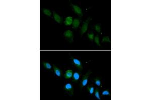 Immunofluorescence analysis of U2OS cell using HLA-A antibody. (HLA-A 抗体  (AA 35-285))