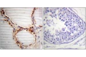 Immunohistochemistry analysis of paraffin-embedded human testis tissue, using MCM4 (Ab-54) Antibody. (MCM4 抗体  (AA 20-69))