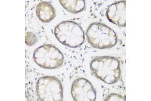 Immunohistochemistry of paraffin-embedded human colon using NFU1 antibody at dilution of 1:200 (40x lens). (NFU1 抗体)