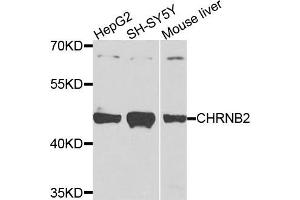 Western blot analysis of extracts of various cells, using CHRNB2 antibody. (CHRNB2 抗体)