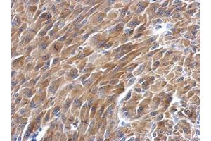 IHC-P Image Immunohistochemical analysis of paraffin-embedded U87 xenograft, using BAG2, antibody at 1:500 dilution. (BAG2 抗体)