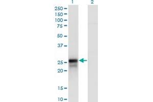Western Blot analysis of DIRAS2 expression in transfected 293T cell line by DIRAS2 polyclonal antibody (A01). (DIRAS2 抗体  (AA 81-180))