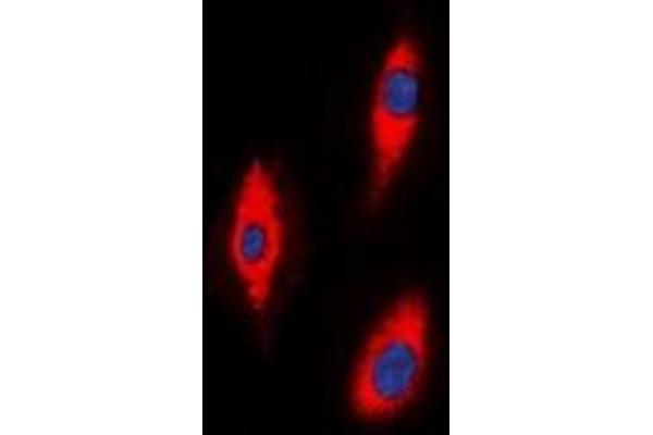ZNRF2 抗体  (C-Term)