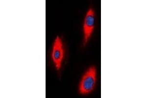 Immunofluorescent analysis of ZNRF2 staining in A549 cells. (ZNRF2 抗体  (C-Term))