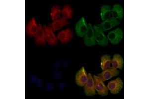 ABIN6261245 and ABIN6273225 staining Hela cells by IF/ICC.