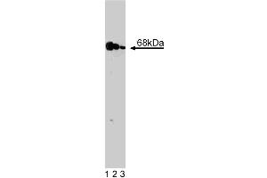 Western blot analysis of PKR on a A431 cell lysate (Human epithelial carcinoma, ATCC CRL-1555).