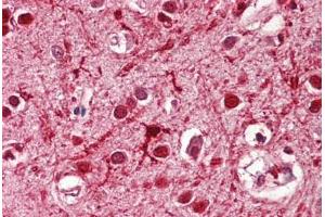 Image no. 2 for anti-Achaete-Scute Complex Homolog 3 (ASCL3) (AA 118-130) antibody (ABIN1495987) (ASCL3 抗体  (AA 118-130))