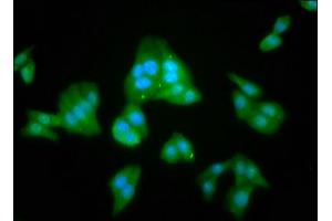 Immunofluorescence staining of HepG2 cells with ABIN7157906 at 1:100, counter-stained with DAPI. (LANCL2 抗体  (AA 2-106))