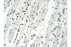 Image no. 1 for anti-Tripartite Motif Containing 32 (TRIM32) (AA 559-608) antibody (ABIN324509) (TRIM32 抗体  (AA 559-608))