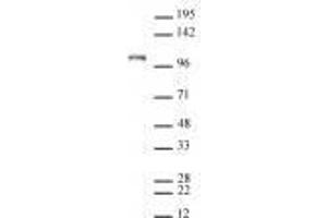 Mili / PiwiL2 antibody (rAb) tested by Western blot. (Recombinant PIWIL2 抗体)