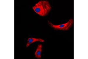 Immunofluorescent analysis of Kallikrein 3 staining in LNCaP cells. (Prostate Specific Antigen 抗体  (Center))