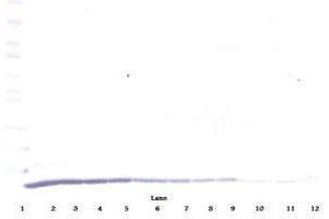 Image no. 1 for anti-Chemokine (C-C Motif) Ligand 22 (CCL22) antibody (ABIN465130) (CCL22 抗体)