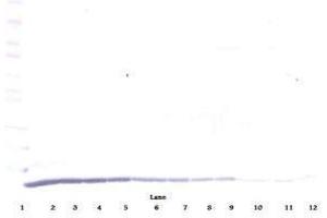 Image no. 1 for anti-Chemokine (C-C Motif) Ligand 22 (CCL22) antibody (ABIN465130)