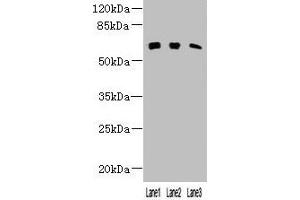 Western blot All lanes: KLHL23 antibody at 3 μg/mL Lane 1: Mouse lung tissue Lane 2: Human placenta tissue Lane 3: HL60 whole cell lysate Secondary Goat polyclonal to rabbit IgG at 1/10000 dilution Predicted band size: 64 kDa Observed band size: 64 kDa (KLHL23 抗体  (AA 1-200))