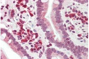 Human Small Intestine: Formalin-Fixed, Paraffin-Embedded (FFPE) (DERL1 抗体  (AA 224-251))
