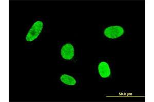 Immunofluorescence of monoclonal antibody to GSC on HeLa cell. (GSC 抗体  (AA 151-257))