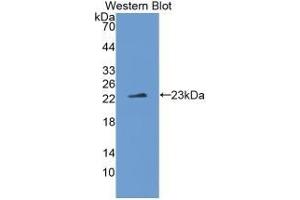 Detection of Recombinant IL1z, Human using Monoclonal Antibody to Interleukin 1 Zeta (IL1z) (IL-37 抗体  (AA 27-192))