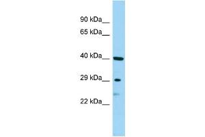 WB Suggested Anti-SBSN Antibody Titration: 1. (Suprabasin 抗体  (Middle Region))