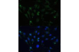 Immunofluorescence analysis of C6 cells using ZWINT Polyclonal Antibody (ABIN6128944, ABIN6150552, ABIN6150554 and ABIN6221938) at dilution of 1:100 (40x lens). (ZWINT 抗体  (AA 1-277))