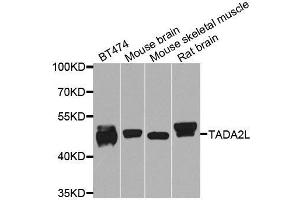 Western blot analysis of extracts of various cell lines, using TADA2A antibody. (TADA2L 抗体  (AA 1-443))