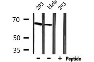 Western blot analysis of extracts from 293 and Hela, using MBD1 Antibody. (MBD1 抗体  (C-Term))