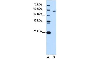 PKLR antibody used at 5 ug/ml to detect target protein. (PKLR 抗体  (N-Term))
