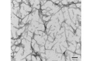 TEM of recombinant Tau441 (2N4R), P301S mutant Pre-formed Fibrils (PFFs) at 150kx magnification. (tau Protein (full length, Pro301Ser-Mutant))