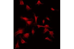 ABIN6274303 staining COLO205 by IF/ICC. (ST5 抗体  (Internal Region))