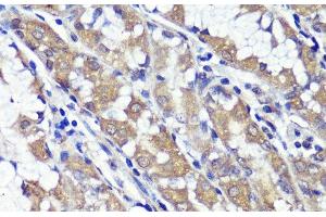 Immunohistochemistry of paraffin-embedded Human stomach using UBL3 Polyclonal Antibody at dilution of 1:100 (40x lens). (UBL3 抗体)