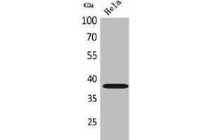 Western Blot analysis of HeLa cells using CD158b2/j Polyclonal Antibody. (KIR2DL3/KIR2DS2 (Internal Region) 抗体)