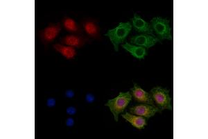 ABIN7094461 and ABIN7098509 staining HepG2 cells by IF/ICC.