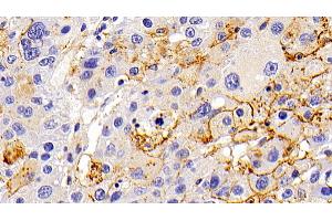 Immunohistochemistry (IHC) image for anti-Lysosomal-Associated Membrane Protein 1 (LAMP1) (AA 49-297) antibody (ABIN7439003)