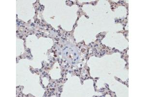 Immunohistochemistry of paraffin-embedded Rat lung using Phospho-Jak2(Y1007/1008) Polyclonal Antibody at dilution of 1:200 (40x lens). (JAK2 抗体  (pTyr1007, pTyr1008))