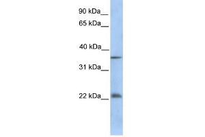 WB Suggested Anti-RYBP Antibody Titration:  0. (RYBP 抗体  (C-Term))