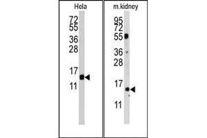 Image no. 1 for anti-Cytidine Deaminase (CDA) (AA 59-89) antibody (ABIN358053) (CDA 抗体  (AA 59-89))