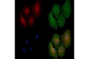 ABIN6258918 and ABIN6274669 staining  cells by IF/ICC. (GBP1 抗体  (C-Term))
