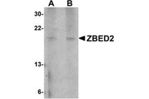Western blot analysis of ZBED2 in A549 cell lysate with this product at (A) 1 and (B) 2 μg/ml. (ZBED2 抗体  (N-Term))