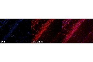 Immunohistochemistry analysis using Rabbit Anti-GRP78 Polyclonal Antibody (ABIN2486757). (GRP78 抗体  (APC))