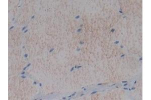 Detection of FMOD in Rat Skeletal muscle Tissue using Polyclonal Antibody to Fibromodulin (FMOD) (Fibromodulin 抗体  (AA 19-376))