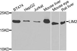Western blot analysis of extracts of various cell lines, using LIM2 antibody. (LIM2 抗体)