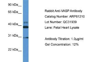 Western Blotting (WB) image for anti-Vasodilator-Stimulated phosphoprotein (VASP) (Middle Region) antibody (ABIN2774308) (VASP 抗体  (Middle Region))
