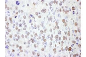 Immunohistochemistry (IHC) image for anti-Structural Maintenance of Chromosomes 1A (SMC1A) (AA 1183-1233) antibody (ABIN7454968) (SMC1A 抗体  (AA 1183-1233))